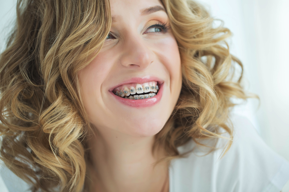 Your Guide to Orthodontic Solutions at Sublime Dental